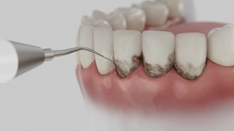 Reliable Dental Implants contractor in El Segundo, CA by Smile Center Dentistry